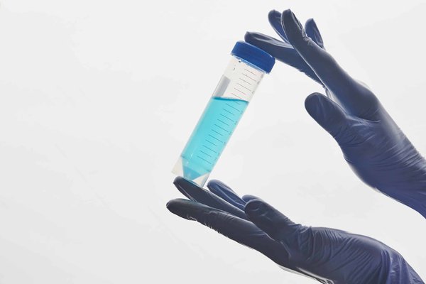 Quelle quantité de vinaigre blanc dans la machine à  laver ?